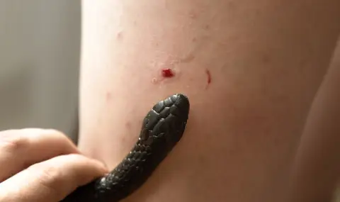 11-годишен умря в адски мъки след ухапване на змия, баща му го взел за пиян - 1