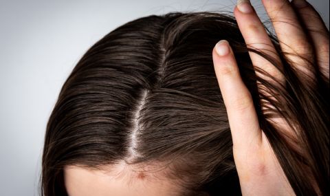 4 начина да се справим с бързото омазняване на косата - 1