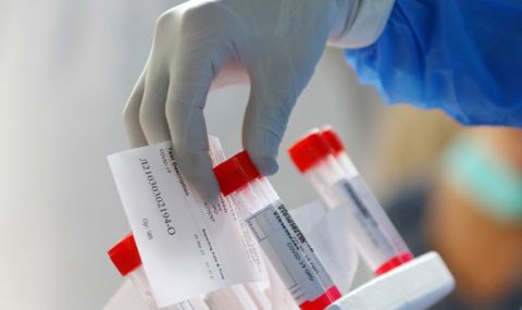 354 нови случаи на коронавирус, починаха още 7 заразени - 1