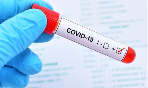 Италиански учени: 99% от починалите от коронавирус са... - 1