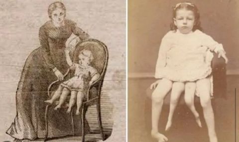 Необичайната история на жената с два чифта крака и втори полов орган - 1