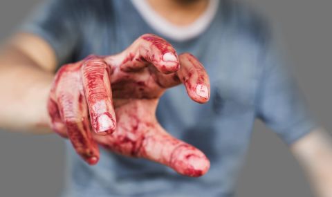 В Кюстендил насилник счупи носа на жена си - 1
