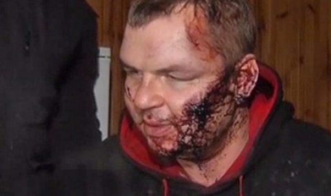 Отвлекли и измъчвали лидер на Автомайдана, за да разберат кой го финансира - 1