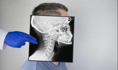 Учени откриха нов орган в центъра на главата - 1
