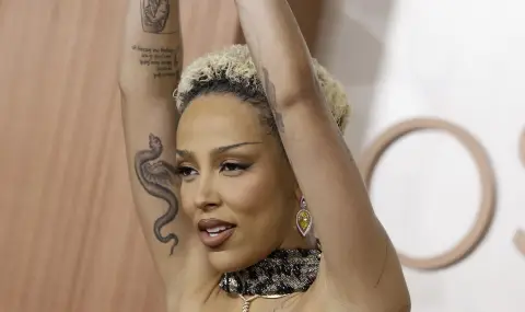 Певицата Дожа Кет разкри, че страда от тежко психическо заболяване  - 1