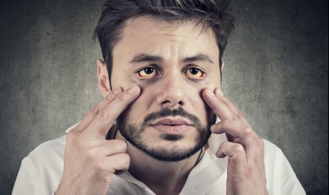 Лицето издава какво е състоянието на черния ви дроб - 1