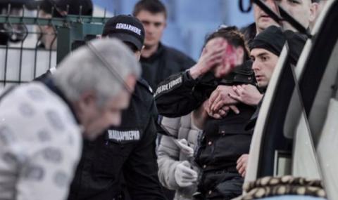 Лекарите са оптимисти за зрението на пострадалата полицайка на мача между Левски и ЦСКА - 1