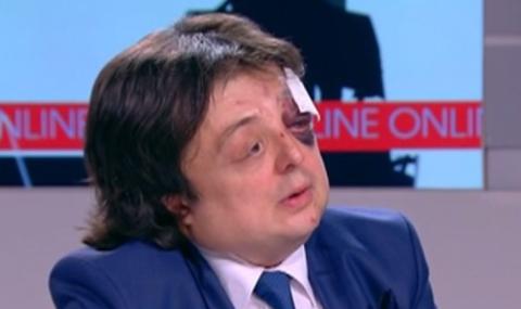 Пребитият Григор Здравков: Поръча ме Димитър Каратиста - 1