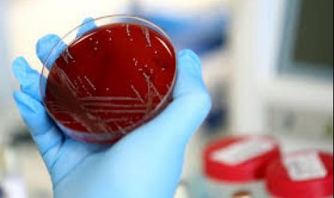 33 нови случая на коронавирус за последните 24 часа - 1