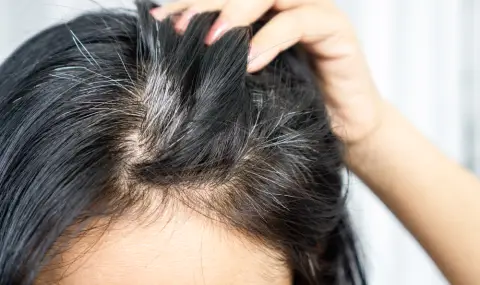 Научно откритие как да не ни побелява косата - 1