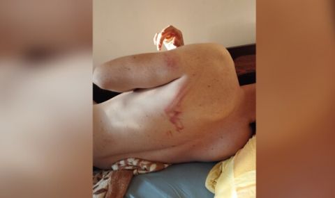 Млад мъж се оплака от полицейско насилие в Козлодуй - 1