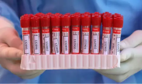 Отново ръст на заразените с коронавирус в България - 1