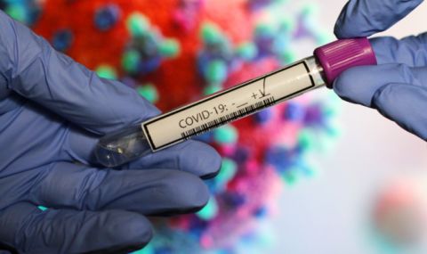 631 нови случаи на коронавирус, починаха още 11 заразени - 1