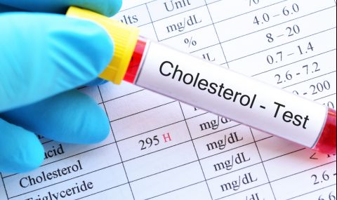Кога се изследва холестеролът? - 1