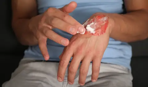 Корейски учени създадоха прах, който моментално запечатва рани - 1