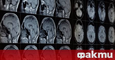 Японски учени са установили че намаляването на активността на определен