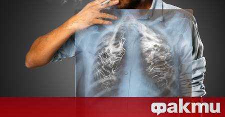 Снимки от китайски лекари изследващи белите дробове на починал пациент