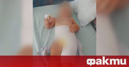 2 годишно дете е получило изгаряния по време на престоя си