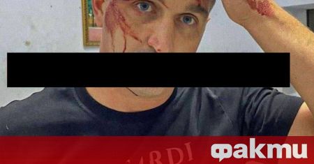 Russian Politician Attacked in Mariupol: Residents’ Resistance to Russian Occupiers
