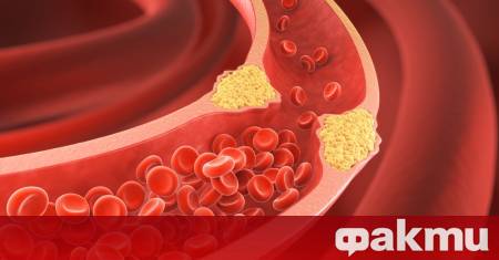 Здравните експерти предупреждават че често срещан проблем с холестерола –