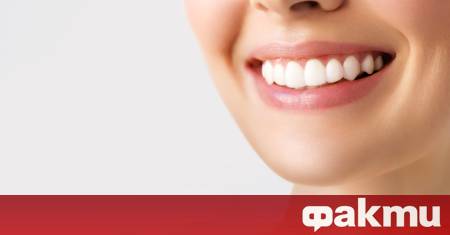 В ерата на холивудските усмивки и перфектната естетика белите зъби