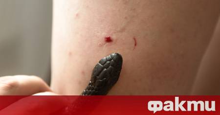 В Австралия момче почина от рядко усложнение след ухапване от