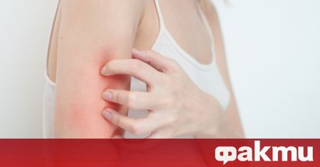 Британски дерматолози посочиха три симптома по кожата които показват наличието