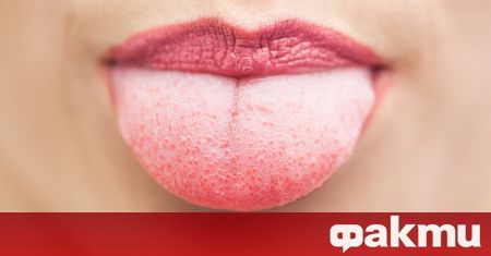 Проучване разкрива че при заразяване с коронавирус на езика могат