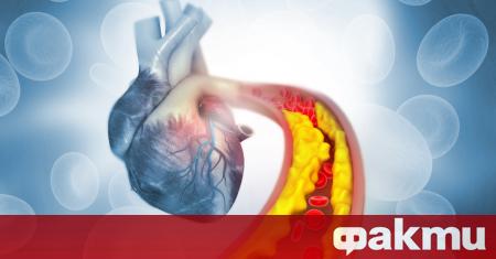 Турският кардиолог Ендер Сарац разказа как да намалим нивото на