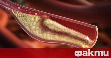 Нивото на холестерола в човешката кръв зависи от много фактори