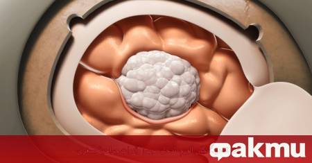 Американските невролози Саеф Изи и Сандро Марини са на мнение