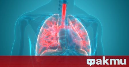 Пневмонията е възпаление на белите дробове което може да доведе