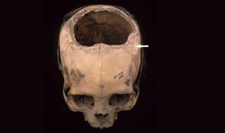 Инките били по-добри мозъчни хирурзи от лекарите през 19-ти век в САЩ