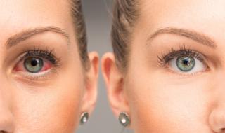 Паренето на очите е симптом на смъртоносна болест