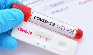 1 107 нови случаи на коронавирус, починаха двама заразени