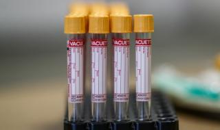 БАН: Лечението на COVID-19 с плазма е обещаващо