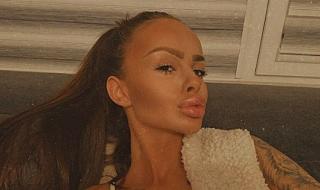 Сузанита намали устните си, резултатът е удивителен (ВИДЕО)