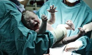 Бебе-русалка се роди в Индия