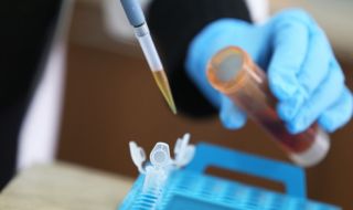 242 нови случаи на коронавирус, починаха още петима заразени