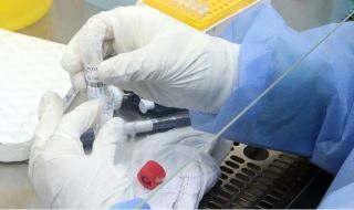 84 нови случая на коронавирус, почина един пациент