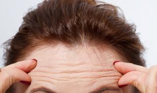 Бръчките по челото предсказват риск от сърдечни заболявания