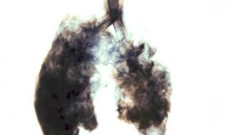 От кои белодробни заболявания страдат пушачите?