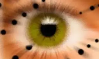 Why do we see strange colored spots in front of our eyes 
