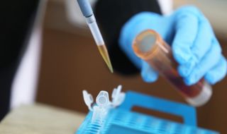 263 нови заразени с коронавирус, починаха двама инфектирани