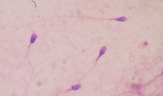 Еволюция: сперма от женски клетки