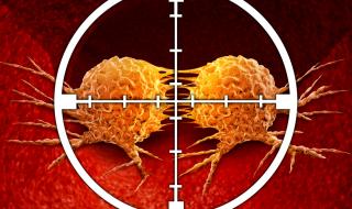 Основната причина за рак при хората над 20-годишна възраст е...