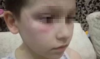 В Русия нарекоха 9-годишно момче "украинец" и го пребиха