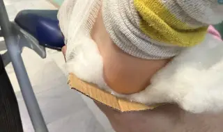 Шинираха с картон от кутия за пица счупен крак на дете