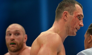 Фюри и Кличко - сензация или фарс?