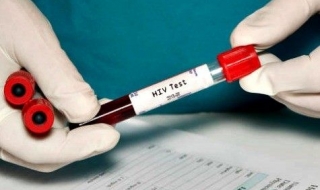 Нова надежда за лек срещу ХИВ